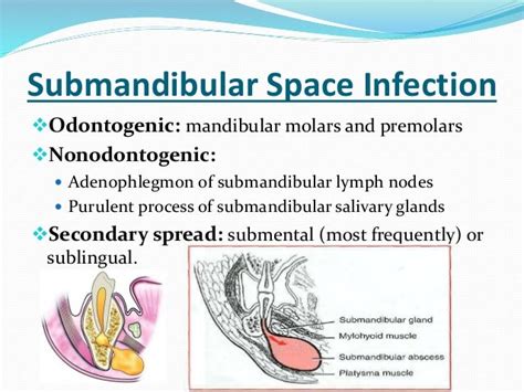 Abscess and phlegmon in maxillofacial region odontogenic infections-