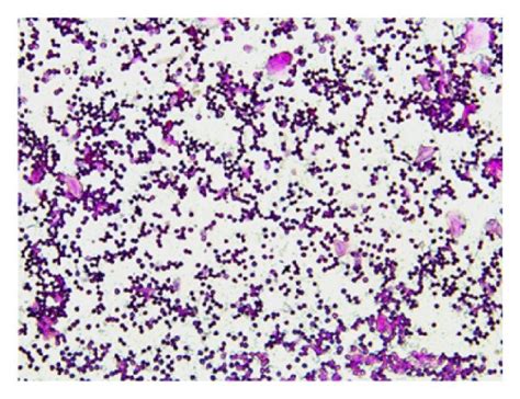 Mice typical vaginal smear of different stages of the oestrous cycle... | Download Scientific ...