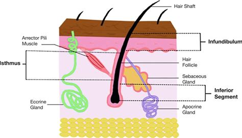 Histopathology of the Pilosebaceous Unit and Interstitium of Hidradenitis Suppurativa | Plastic ...