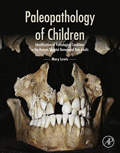 Paleopathology of Children: Identification of Pathological Conditions in the Human Skeletal ...