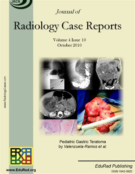 Vol 4, No 10 (2010) | Free journal access | Radiology Journal