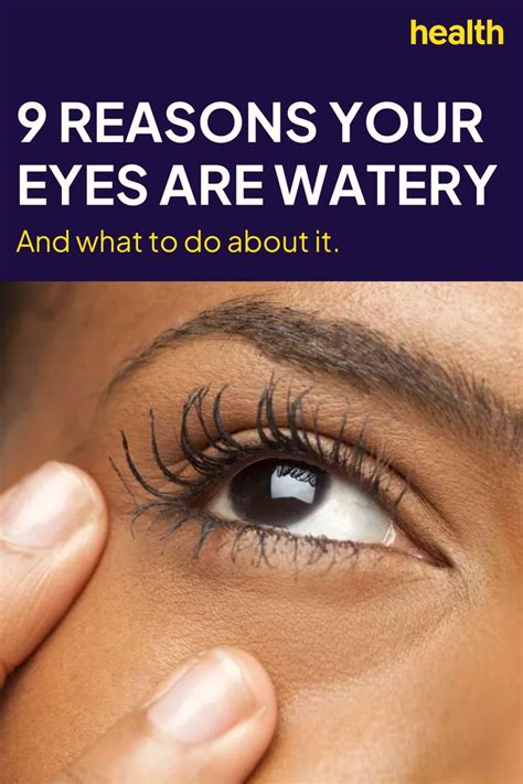 Watery Eyes Can Be Annoying—11 Causes, Plus Tips