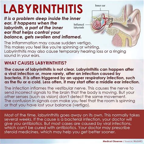 labyrinthitis | Chronic migraines, Inner ear disorders, Vertigo
