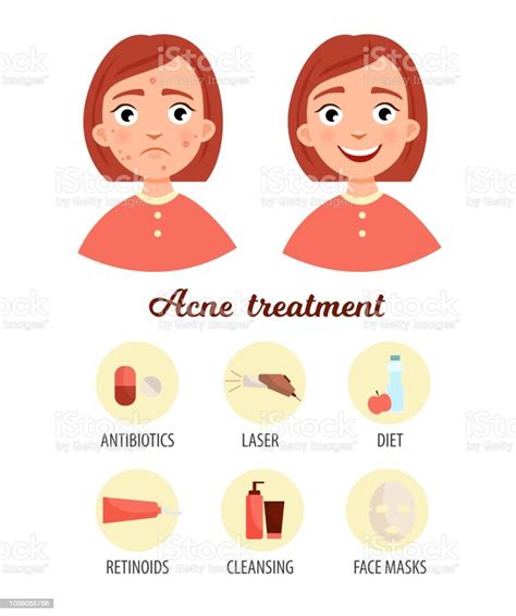 Treatment Of Acne Stock Illustration - Download Image Now - Acne ...