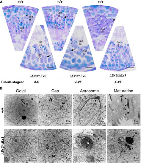 Acrosome formation is impaired during Vps13b∆Ex3/∆Ex3 spermiogenesis. a ...