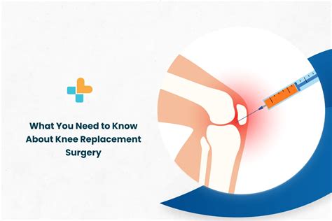 What You Need To Know About Knee Replacement Surgery