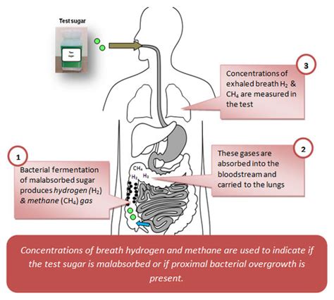 Breath Tests; Breathalyzer Tests