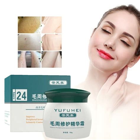 LINMalic Acid Treatment Body Ichthyosis Leg Keratosis Follicularis Cream Natural Thigh Fish ...