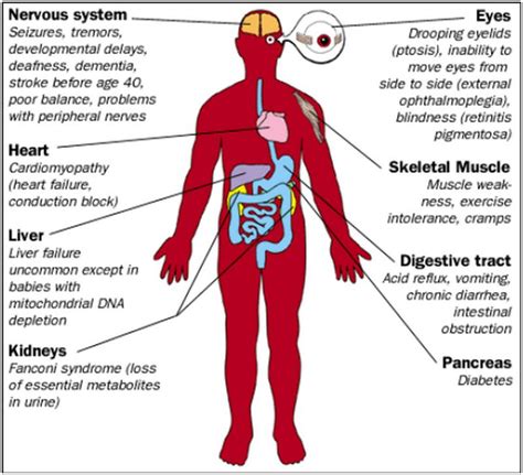 The symptoms of Kearns-Sayre syndrome. | Rapiditas