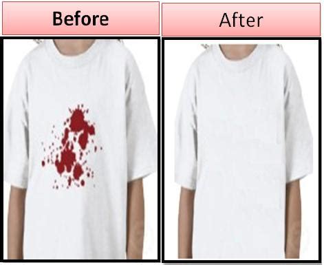 How to Get Rid of Blood Stains on Clothes