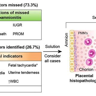 Correlation between clinical indicators of chorioamnionitis and ...