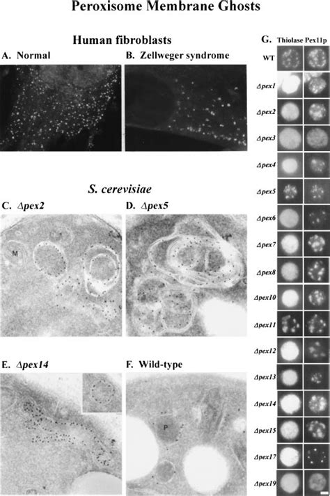 Peroxisome membrane ghosts (A,B) Human fibroblasts-immunfluorescence ...