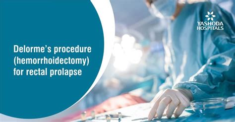 Delorme’s procedure (hemorrhoidectomy) for rectal prolapse - Yashoda Hospitals