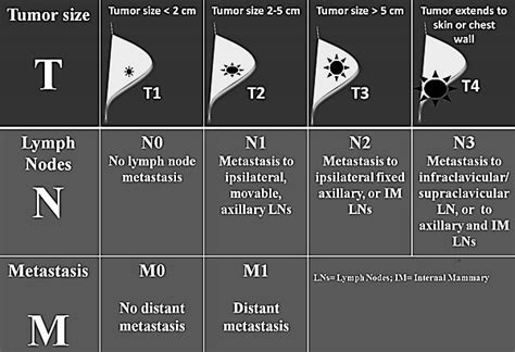 TNM and Staging of Breast Cancer Simplified | Epomedicine