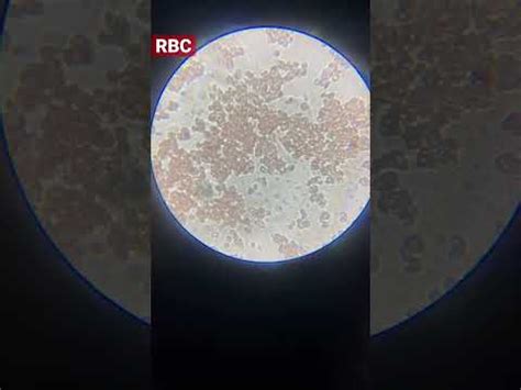 RBC /microscope 🔬 - YouTube