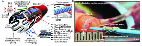 The bioresorbable electronic stent. A The structure illustration. B The ...