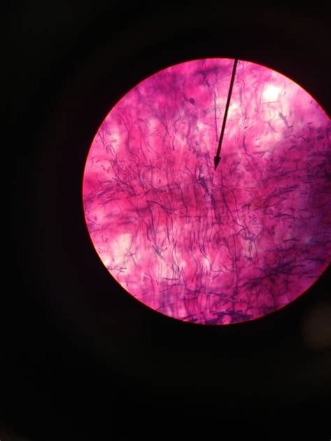 Pin on Epithelial and Connective Tissue