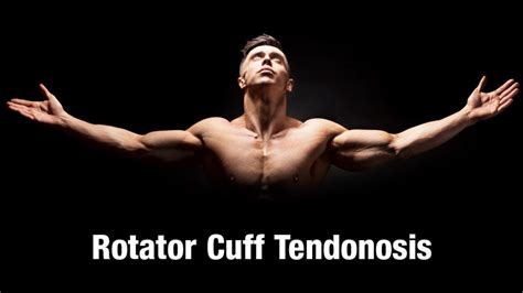 Rotator Cuff Tendonosis Exercises - Kerrisdale Physiotherapy