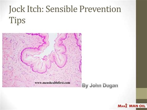 PPT - Jock Itch: Sensible Prevention Tips PowerPoint Presentation, free download - ID:7845691