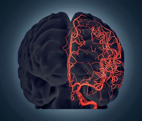 Vascular System Brain