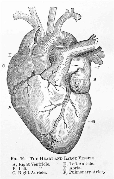 Heart Disease Drawing at PaintingValley.com | Explore collection of ...