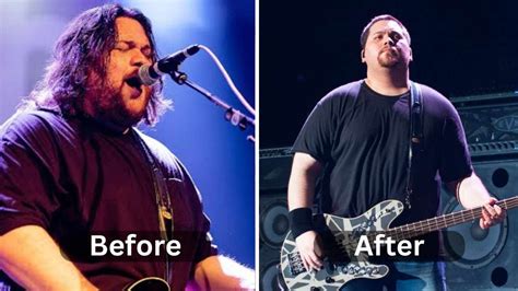 Wolfgang Van Halen: Weight Loss, Net Worth, Height and Surgery - Weight Loss