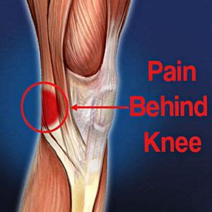 ปักพินในบอร์ด Pain Behind knee