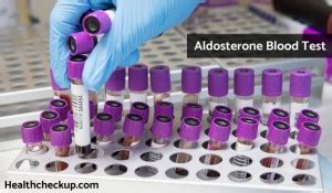 Aldosterone Test - Purpose, Procedure, Results, Normal Range