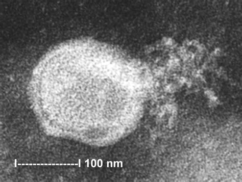 Human metapneumovirus