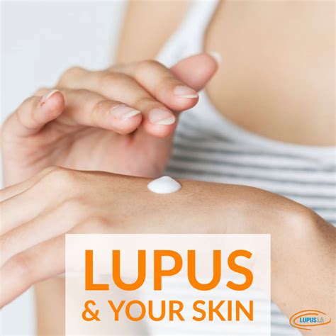 Living With Lupus: How To Care For Your Skin - LUPUS LA