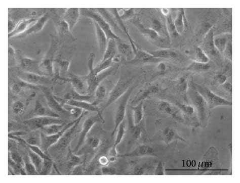 Microphotographs of MDA-MB-231 by optical microscopy. MDA-MB-231 cell ...