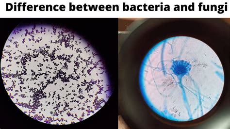 Differences and Similarities Between Bacteria and Fungi – Microbe Online