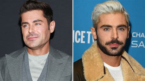 Zac Efron's Jaw Injury And Plastic Surgery Explained - Capital