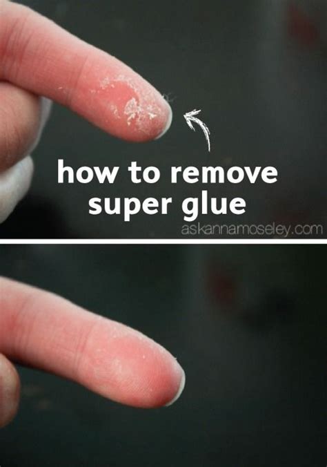 How to get Super Glue off Skin | Super glue, Remove super glue, Glue