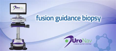 MRI/Ultrasound Fusion Biopsy | UroNav | Prostate Cancer