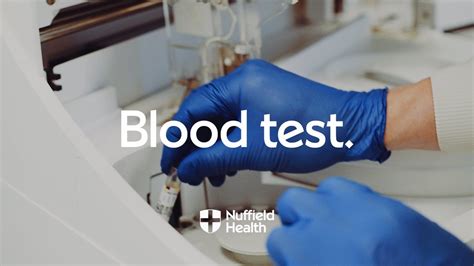 Blood Test Procedure | Nuffield Health - YouTube