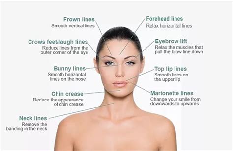 botox brow lift botox injection sites diagram - AsianaPeighton