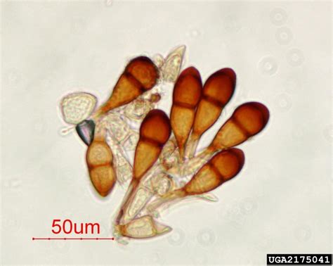 wheat stem rust (Puccinia graminis Pers.)