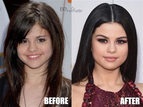 Selena Gomez All Plastic Surgery Revealed – Before and After Pictures ...