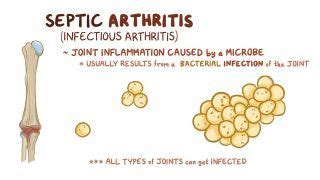 What Causes Septic Bursitis