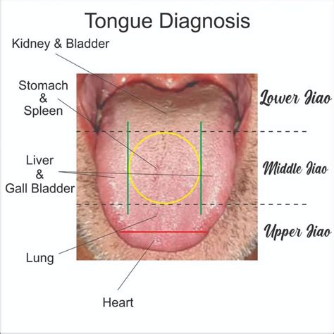 Prior to Acupucture Tongue Diagnosis