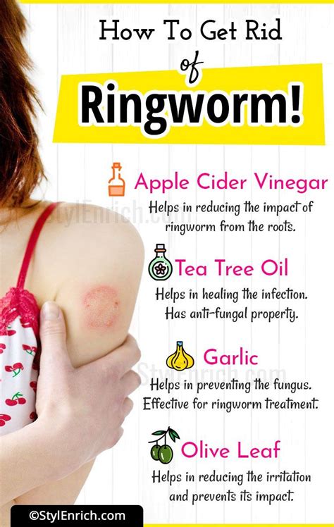 Healing Ringworm Stages Pictures - PictureMeta