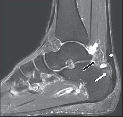 Clinics in diagnostic imaging (170) | SMJ