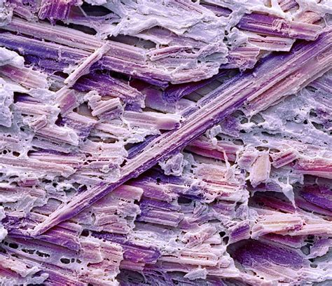 Uric Acid Crystals Photograph by Steve Gschmeissner - Pixels