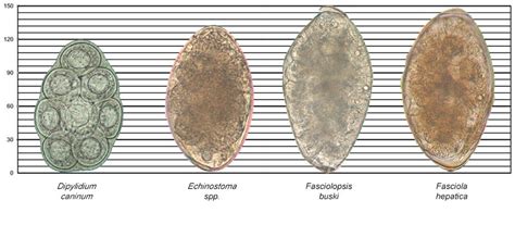 Images of Dipylidium caninum, Echinostoma spp., Fasciolopsis buski, and ...