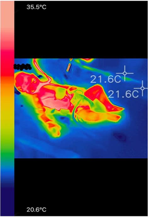 Frontiers | Hemodynamic assessment in children after cardiac surgery: A ...