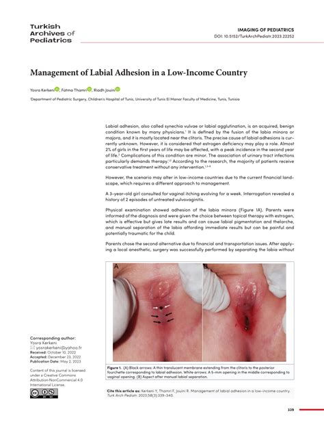 (PDF) Management of Labial Adhesion in a Low-Income Country