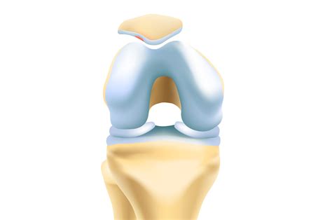 Patellofemoral Treatment | Kneecap Surgery