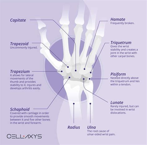 Ulnar Wrist Pain: Why Ulnar Shortening Osteotomy Is Not Ideal? - Cellaxys