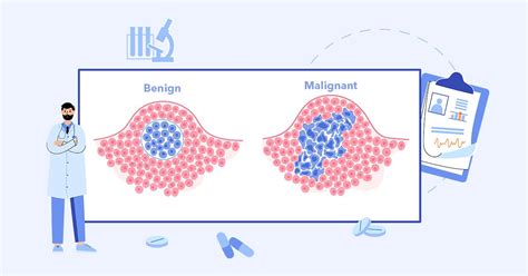 What Is A Malignant Neoplasm? - Health365.sg